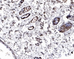 H4K8ac Recombinant Rabbit Monoclonal Antibody (PS01-25), Invitrogen 100