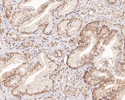 Invitrogen WDR77 Recombinant Rabbit Monoclonal Antibody (PSH0-07) 100 &mu;L;