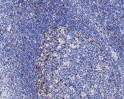 Invitrogen CTLA-4 Recombinant Rabbit Monoclonal Antibody (PS01-34) 100