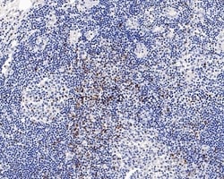 Invitrogen CTLA-4 Recombinant Rabbit Monoclonal Antibody (PS01-34) 100