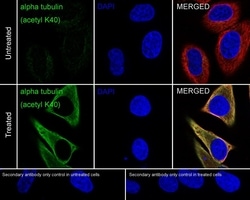 Invitrogen Acetyl-alpha Tubulin (Lys40) Recombinant Rabbit Monoclonal Antibody