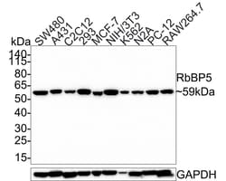 Invitrogen RBBP5 Recombinant Rabbit Monoclonal Antibody (PSH0-15) 100 &mu;L;