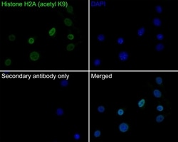 Invitrogen H2AK9ac Recombinant Rabbit Monoclonal Antibody (PS01-45) 100