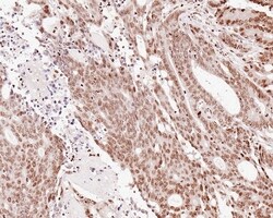 Invitrogen H2AK9ac Recombinant Rabbit Monoclonal Antibody (PS01-45) 100