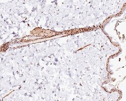 Invitrogen H2AK9ac Recombinant Rabbit Monoclonal Antibody (PS01-45) 100