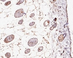 Invitrogen H2AK9ac Recombinant Rabbit Monoclonal Antibody (PS01-45) 100