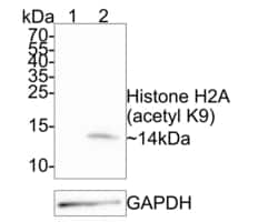 Invitrogen H2AK9ac Recombinant Rabbit Monoclonal Antibody (PS01-45) 100