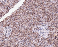 Invitrogen TNF alpha Recombinant Rabbit Monoclonal Antibody (PS00-40) 100