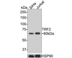 Invitrogen TRF2 Recombinant Rabbit Monoclonal Antibody (JE37-57) 100 &mu;L | Buy Online | Invitrogen&trade; | Fisher Scientific