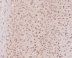 Invitrogen PSMC5 Recombinant Rabbit Monoclonal Antibody (PSH0-22) 100 &mu;L | Buy Online | Invitrogen&trade; | Fisher Scientific