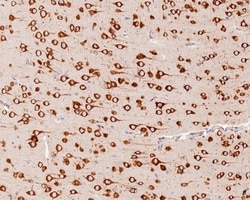 Invitrogen YTHDF1 Recombinant Rabbit Monoclonal Antibody (PSH0-23) 100
