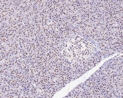 Invitrogen PBX1 Recombinant Rabbit Monoclonal Antibody (PSH0-24) 100 &mu;L | Buy Online | Invitrogen&trade; | Fisher Scientific