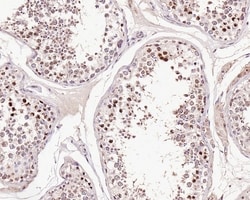 Invitrogen CDC6 Recombinant Rabbit Monoclonal Antibody (JE59-52) 100 &mu;L;