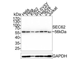 Invitrogen SEC62 Recombinant Rabbit Monoclonal Antibody (PSH0-25) 100 &mu;L;