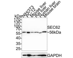Invitrogen SEC62 Recombinant Rabbit Monoclonal Antibody (PSH0-25) 100 &mu;L;