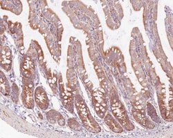 Invitrogen ASC1 Recombinant Rabbit Monoclonal Antibody (PSH0-26) 100 &mu;L;