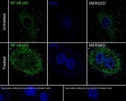 Invitrogen NFkB p65 Recombinant Rabbit Monoclonal Antibody (PSH0-27) 100 &mu;L | Buy Online | Invitrogen&trade; | Fisher Scientific