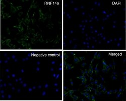 Invitrogen RNF146 Recombinant Rabbit Monoclonal Antibody (PSH0-29) 100