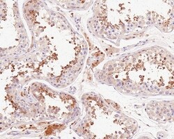 Invitrogen RNF146 Recombinant Rabbit Monoclonal Antibody (PSH0-29) 100