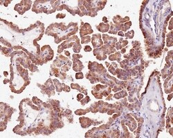 Invitrogen RNF146 Recombinant Rabbit Monoclonal Antibody (PSH0-29) 100