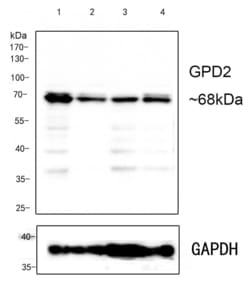 Invitrogen GPD2 Recombinant Rabbit Monoclonal Antibody (PSH0-31) 100 &mu;L;