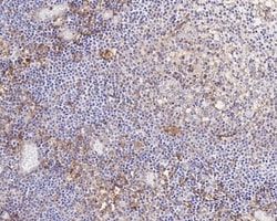Invitrogen SIRP alpha Recombinant Rabbit Monoclonal Antibody (JE36-20)