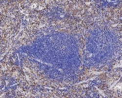 Invitrogen SIRP alpha Recombinant Rabbit Monoclonal Antibody (JE36-20)