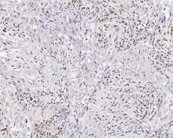 Invitrogen ZEB1 Recombinant Rabbit Monoclonal Antibody (JE57-64) 100 &mu;L | Buy Online | Invitrogen&trade; | Fisher Scientific