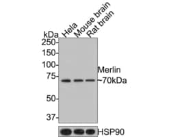 Invitrogen NF2 Recombinant Rabbit Monoclonal Antibody (JE31-02) 100 &mu;L;