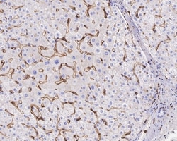 Invitrogen CD14 Recombinant Rabbit Monoclonal Antibody (PD01-63) 100 &mu;L | Buy Online | Invitrogen&trade; | Fisher Scientific