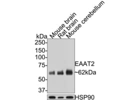 Invitrogen GLT-1 Recombinant Rabbit Monoclonal Antibody (PS01-62) 100 &mu;L | Buy Online | Invitrogen&trade; | Fisher Scientific