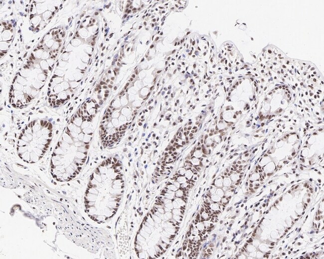 MLH1 Recombinant Rabbit Monoclonal Antibody (PD01-61), Invitrogen 100 ...