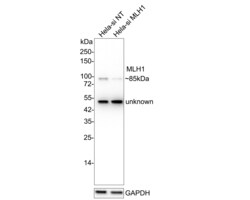 Invitrogen MLH1 Recombinant Rabbit Monoclonal Antibody (PD01-61) 100 &mu;L | Buy Online | Invitrogen&trade; | Fisher Scientific