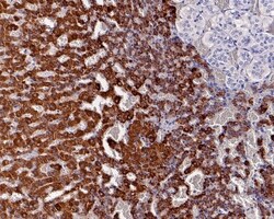 Invitrogen FDX1 Recombinant Rabbit Monoclonal Antibody (JE63-56) 100 &mu;L;