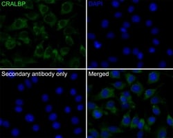 Invitrogen CRALBP Recombinant Rabbit Monoclonal Antibody (JE35-09) 100 &mu;L | Buy Online | Invitrogen&trade; | Fisher Scientific