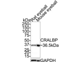 Invitrogen CRALBP Recombinant Rabbit Monoclonal Antibody (JE35-09) 100 &mu;L | Buy Online | Invitrogen&trade; | Fisher Scientific