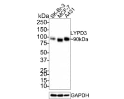 Invitrogen LYPD3 Recombinant Rabbit Monoclonal Antibody (PS00-59) 100 &mu;L | Buy Online | Invitrogen&trade; | Fisher Scientific