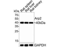 Invitrogen Arp2 Recombinant Rabbit Monoclonal Antibody (JE40-62) 100 &mu;L;