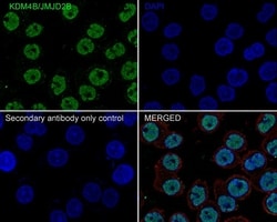 Invitrogen JMJD2B Recombinant Rabbit Monoclonal Antibody (JE36-58) 100