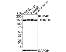 Invitrogen JMJD2B Recombinant Rabbit Monoclonal Antibody (JE36-58) 100