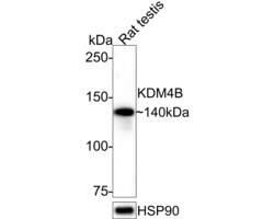 Invitrogen JMJD2B Recombinant Rabbit Monoclonal Antibody (JE36-58) 100