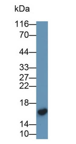 Invitrogen Transthyretin Monoclonal Antibody (D2), Invitrogen 200 &mu;L;