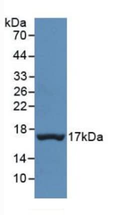 Invitrogen Transthyretin Monoclonal Antibody (D2), Invitrogen 200 &mu;L;