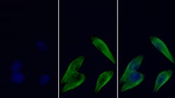 Invitrogen beta Tubulin Monoclonal Antibody (C3), Invitrogen 200 μL;