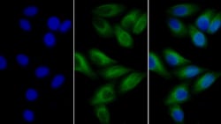 Invitrogen beta Tubulin Monoclonal Antibody (C3), Invitrogen 200 μL;