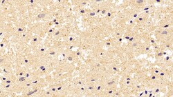 Invitrogen beta Tubulin Monoclonal Antibody (C3), Invitrogen 200 μL;