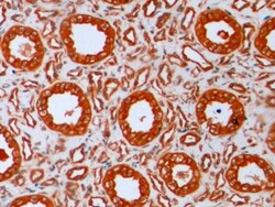 Invitrogen beta Tubulin Monoclonal Antibody (C3), Invitrogen 200 μL;