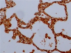 Invitrogen beta Tubulin Monoclonal Antibody (C3), Invitrogen 200 μL;