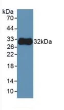 Invitrogen beta Tubulin Monoclonal Antibody (C3), Invitrogen 200 μL;