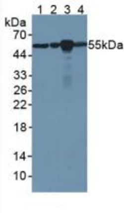 Invitrogen beta Tubulin Monoclonal Antibody (C3), Invitrogen 200 μL;